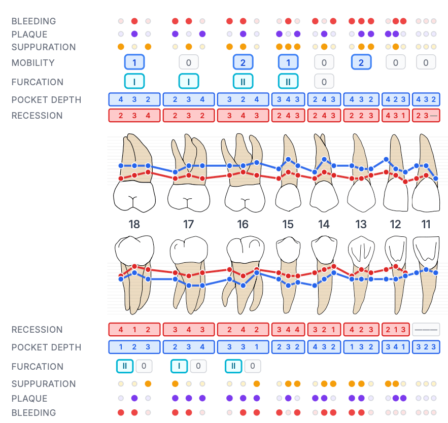 Vue réaliste du graphique parodontal pour l'éducation des patients