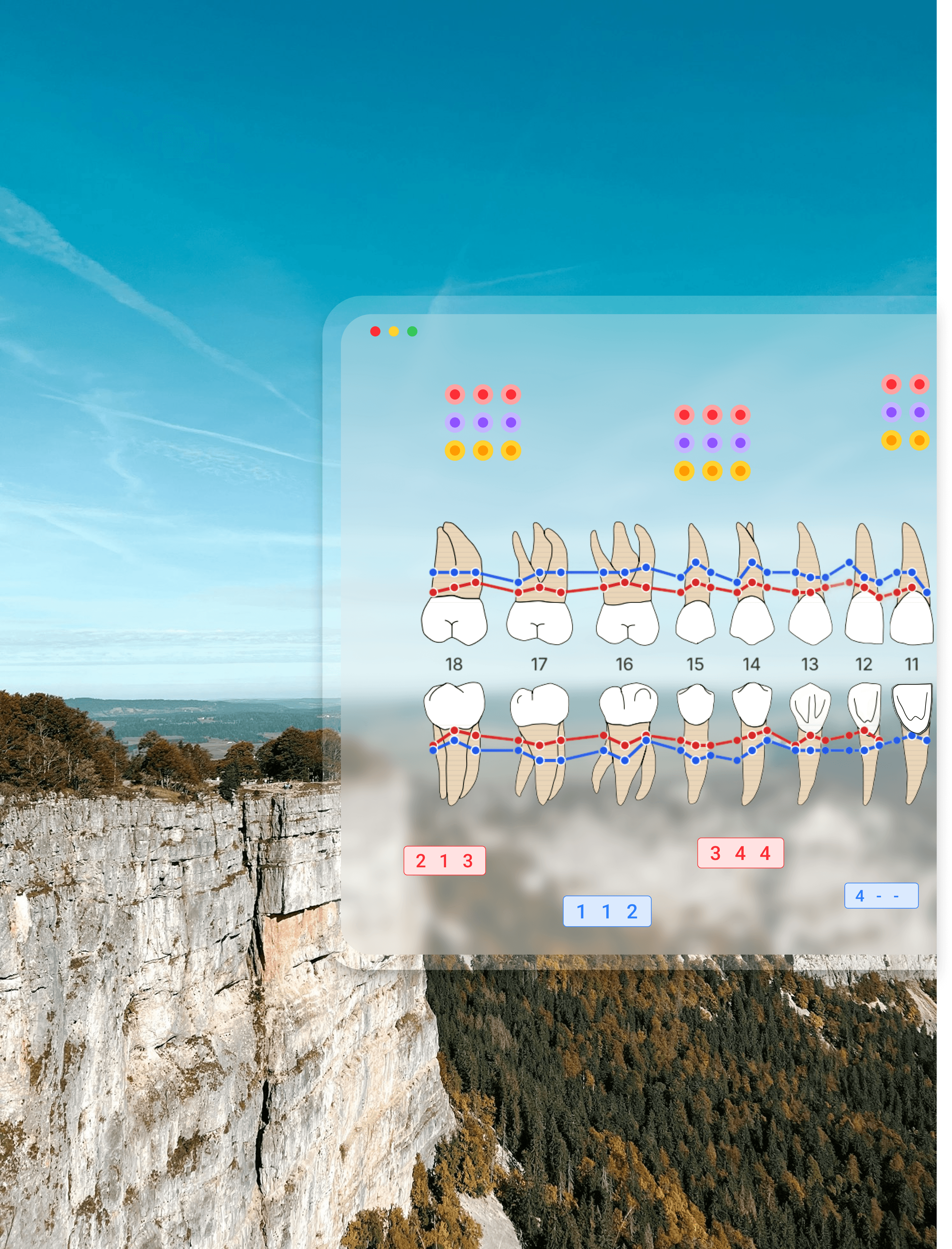 Professionnel dentaire utilisant le graphique parodontal gratuit